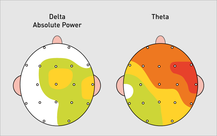 Brainmaps Delta Theta