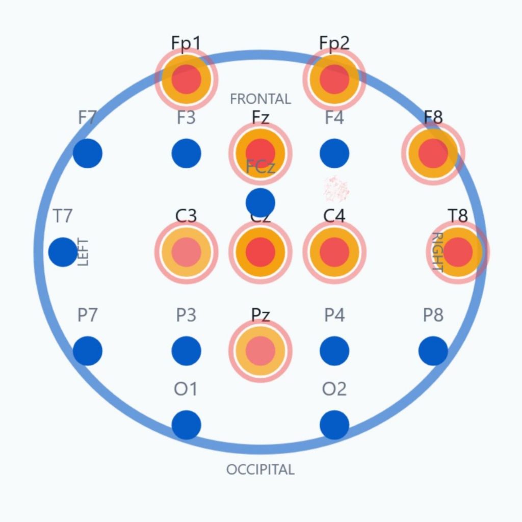 Neurofeedback-Protokoll